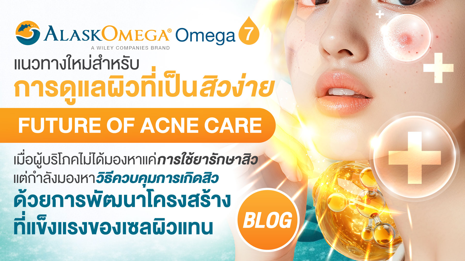 Omega-7 แนวทางใหม่สำหรับการดูแลผิวที่เป็นสิวง่าย Future of Acne Care เมื่อผู้บริโภคไม่ได้มองหาแค่การใช้ยารักษาสิว แต่กำลังมองหาวิธีควบคุมการเกิดสิวด้วยการพัฒนาโครงสร้างที่แข็งแรงของเซลผิวแทน